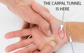 https://turnkeyitworks.com/wp-content/uploads/2026/01/Carpal-Tunnel-337x212-1.jpg