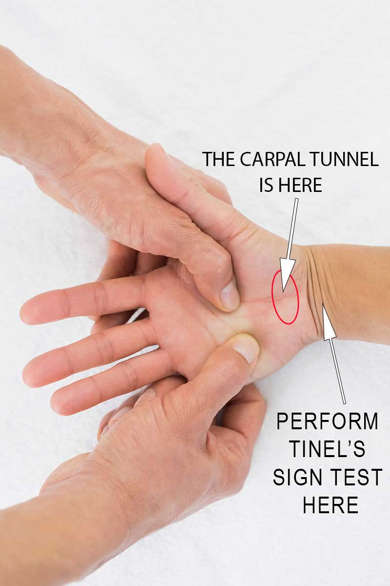 https://turnkeyitworks.com/wp-content/uploads/2026/01/Carpal-Tunnel.jpg