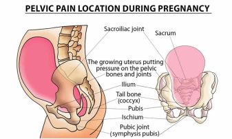 SPD Pubic Bone Pain 2 337x202 https://turnkeyitworks.com/wp-content/uploads/2026/01/SPD-Pubic-Bone-Pain-2-337x202-1.jpg